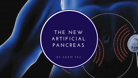 What’s the New “Artificial Pancreas” All About?